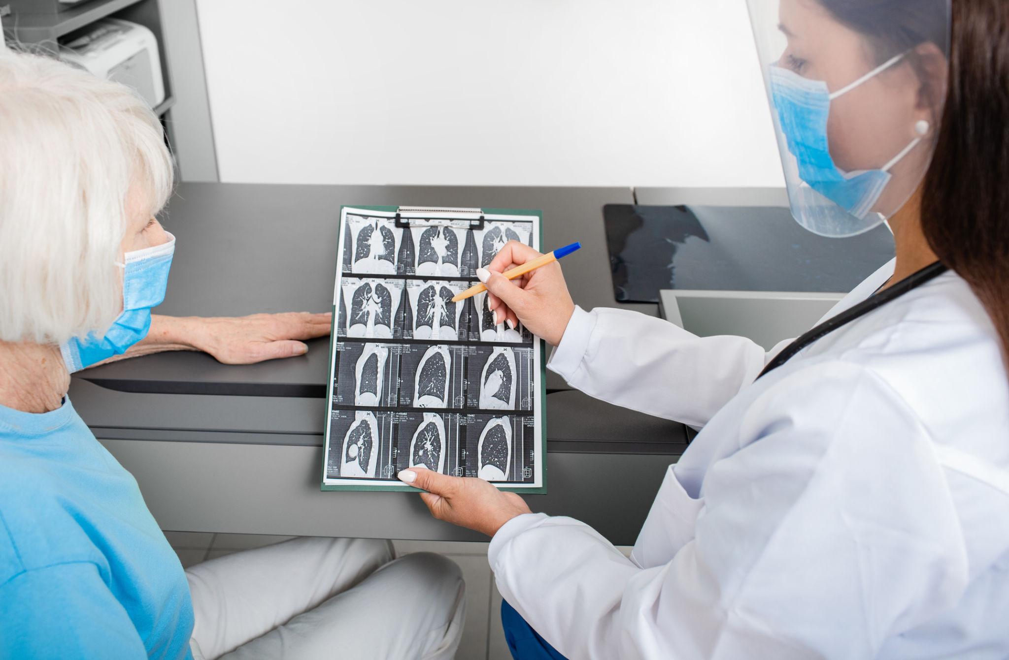 Pirfenidone Price Guide: Cost, Uses & Buying Factors