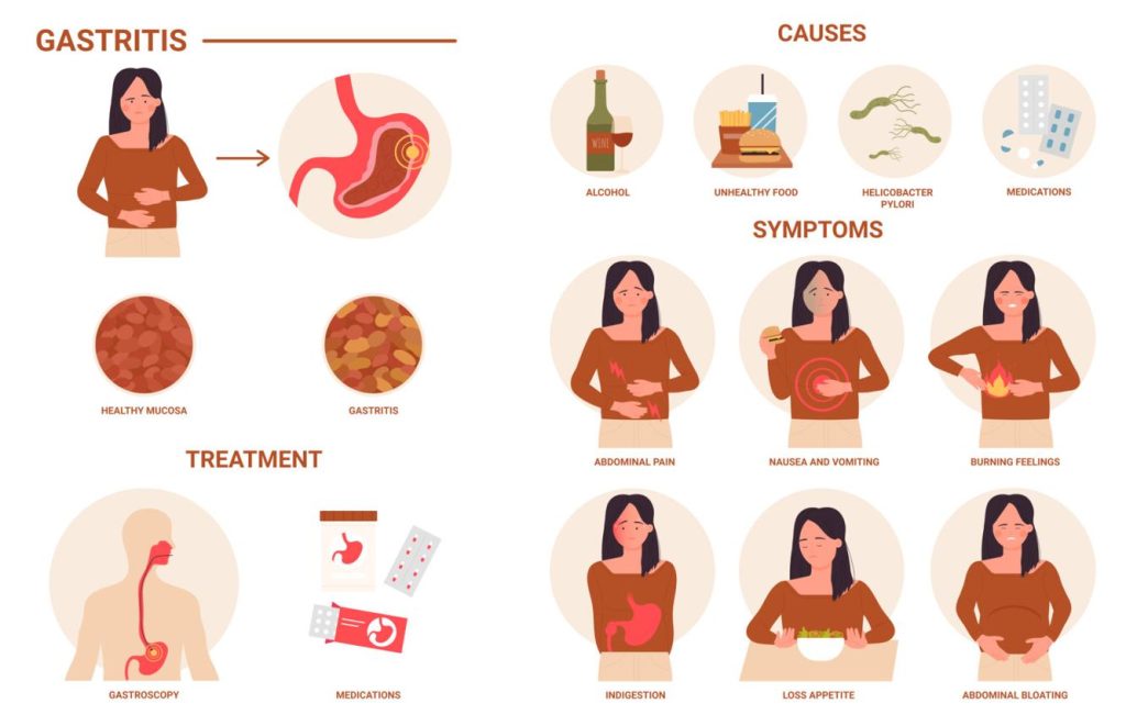 Pirfenidone side effects infographic for idiopathic pulmonary fibrosis patients